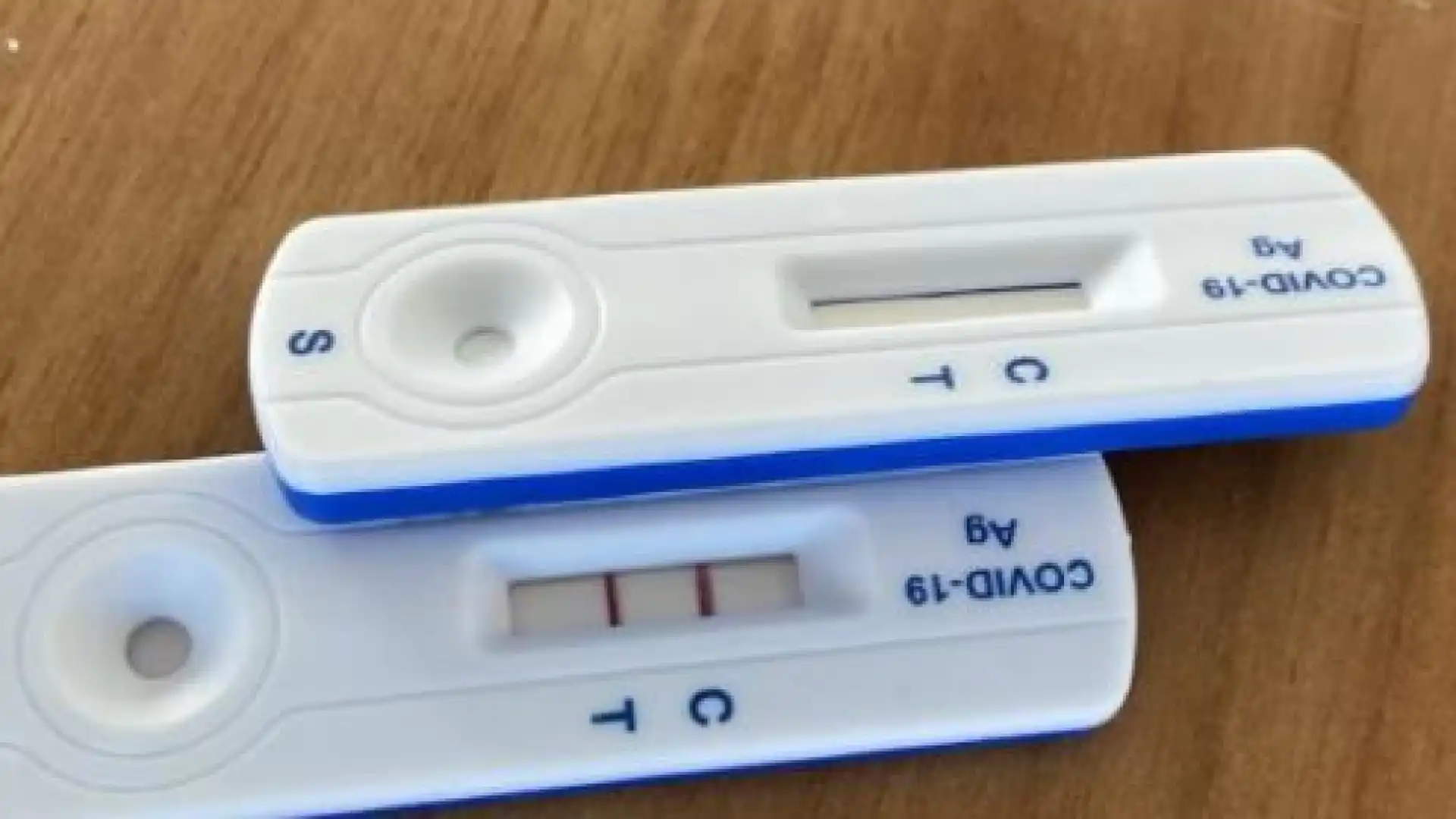 Coronavirus Abruzzo, dati aggiornati al 13 settembre: oggi 850 positivi e 542 guariti